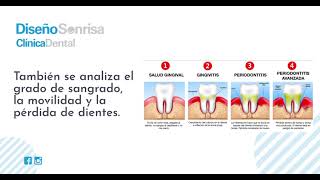 ¿Qué es un periodontograma [upl. by Naziaf]