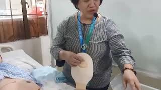 OSTOMY CARE [upl. by Naryb]