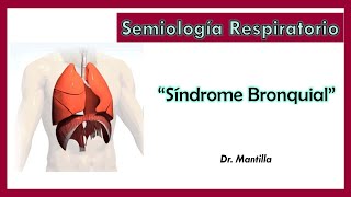 Síndrome Bronquial [upl. by Robert696]