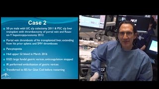 Harbor UCLA 2016 EUS guided coil glue for gastric varices with slide presentation [upl. by Nnodnarb]