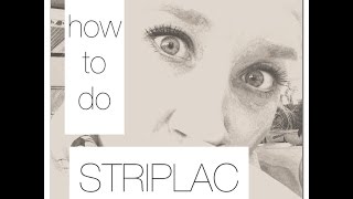 how to do STRIPLAC [upl. by Nnylrats]