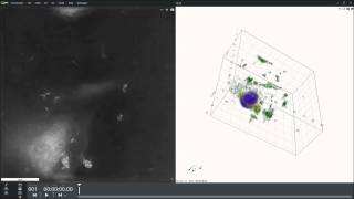 Macrophage eating E Coli [upl. by Moshe]