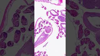 Two lungworm species in one lung histopathology pathology science [upl. by Aindrea]