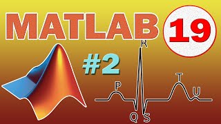 Matlab 19 Synthèse dun signal ECG Périodique  Peigne de Dirac TUTO [upl. by Sekoorb65]