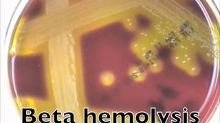 Comparison of hemolysis on blood agarmov [upl. by Petrine]