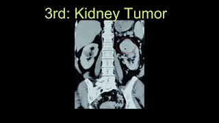 How to take a kidney biopsy properly [upl. by Bergmans861]