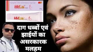 Ointment for melasma। HH lite ointment review Hydroquinone Tretinoin amp Mometasone cream। uses। [upl. by Eddra]