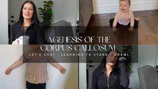 Agenesis of the Corpus Callosum  Let’s Chat  Learning to Stand  crawl [upl. by Aynad]