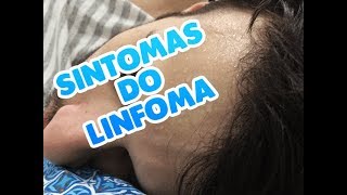 SINTOMAS DO LINFOMA [upl. by Woodberry]