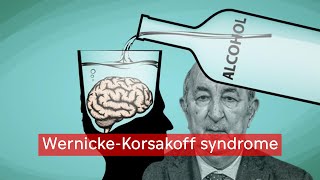 مرض تبون  WernickeKorsakoff syndrome [upl. by Cohl462]