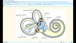 Kanski Clinical Ophthalmology Made Easy  Neuro Ophthalmology 15 Skew deviation and ocular tilt [upl. by Jelena]