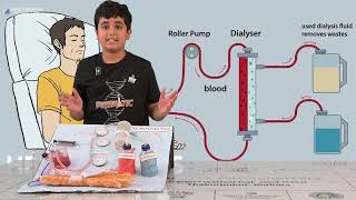 Hemodialysis A LifeSaving Treatment for Kidney Failure [upl. by Ahsyen982]