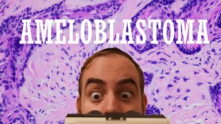 The ULTIMATE Ameloblastoma Review Video [upl. by Anitan]