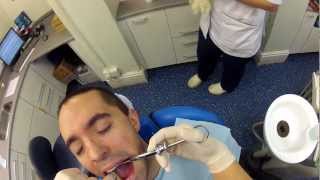 GoPro Wisdom Tooth Removal  2013 [upl. by Nida]