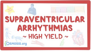 Supraventricular arrhythmias Pathology review [upl. by Ssidnac]