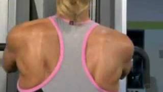 Shoulder Tendonitis Bursitis amp Impingement Syndrome  DePuy Videos [upl. by Ridan780]