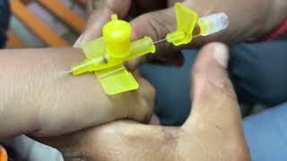 Intravenousiv cannulation [upl. by Tinaret81]