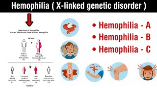 Hemophilia  Xlinked genetic disorder l types and symptoms of hemophilia in Hindi [upl. by Carnahan77]