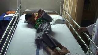 Preoperative Assessment for Dystonic Cerebral Palsy  Dr Paresh K Doshi [upl. by Aeiram]