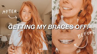 GETTING MY BRACES OFF finally [upl. by Roach]