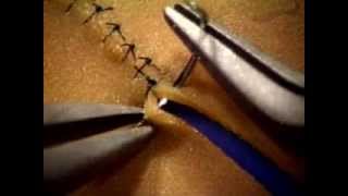 Basic Microsuture Technique [upl. by Nomyad]