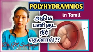 POLYHYRADMNIOS during pregnancy in Tamil by Dr MSukanyaMBBSPGDUSG [upl. by Tymothy917]