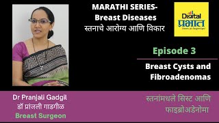 स्तनांमधले सिस्ट व फाइब्रोअडेनोमा  Breast Cysts amp Fibroadenomas Dr Pranjali Gadgil Marathi info [upl. by Ahsinauj]