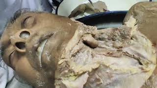 Dissection video by Dr Arnab sir Malda medical college [upl. by Yelahs]