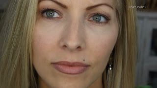 Restylane Filler Injections for Under Eye Puffiness  4 mo Follow Up [upl. by Anirod]