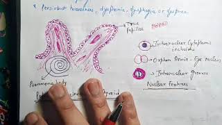 Papillary Carcinoma of Thyroid Pathology [upl. by Dniren]