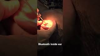 Bluetooth inside ear Dr Hitesh Patel [upl. by Bradly]