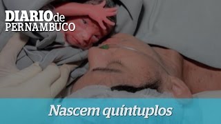 Quíntuplos nascem e passam bem [upl. by Anytsirhc376]