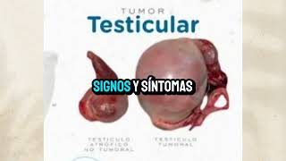 Tumor testicular [upl. by Mclaurin]