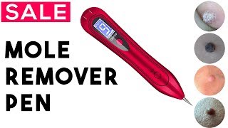 5 Best Mole Remover Pen Review  Skin Tag Removal Pen [upl. by Nauwtna731]