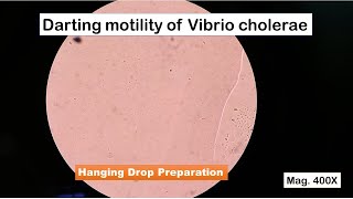 Darting motility of Vibrio cholerae in Hanging Drop preparation [upl. by Town]