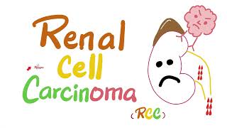 Renal Cell Carcinoma RCC  Kidney Tumors  Neoplasms  Renal Pathology  Nephrology [upl. by Eluk]