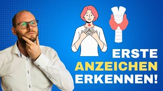 Erste Anzeichen von Schilddrüsenproblemen So erkennst du sie [upl. by Tirrag]