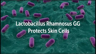 Lactobacillus Rhamnosus GG Protects Skin Cells  Probiotic Skin Acne Psoriasis Eczema [upl. by Amado]