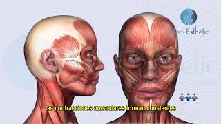 ¿Cómo funciona la Toxina Botulínica Mejor conocida como Botox [upl. by Zelikow386]