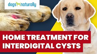 Home Treatment For Interdigital Cysts [upl. by Austin]