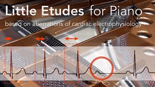 Little Etudes for piano based on aberrations of cardiac electrophysiology [upl. by Nnyletak695]