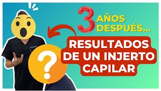 😱👉🏻Resultados después de un INJERTO CAPILAR 👀 [upl. by Eladroc]