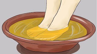 5 Remedios Caseros Para Hongos En Los Pies O Pie De Atleta [upl. by Branscum814]