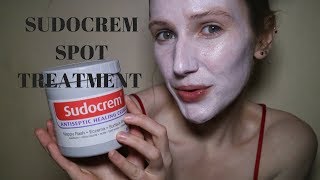 Get rid of spots acne and blemishes FAST Sudocrem Face Mask [upl. by Rehprotsirhc]