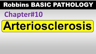 Ch10  Arteriosclerosis  Blood Vessel Pathology  Robbins Lectures [upl. by Marshall250]