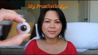 My Prosthetic Eye [upl. by Mojgan66]