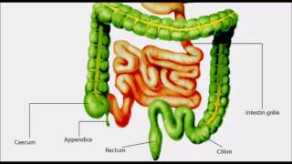 Appendicite inflammation de l’appendice [upl. by Roselle223]