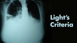 Lights Criteria amp Pleural Effusions  MEDZCOOL [upl. by Akcirederf]