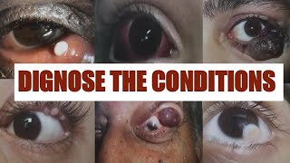 PATHOLOGICAL EYE CONDITIONS 1 Ophthalmology Osce [upl. by Eetsud]