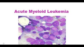 Introduction to Acute myeloid leukemia 2022 [upl. by Argus]